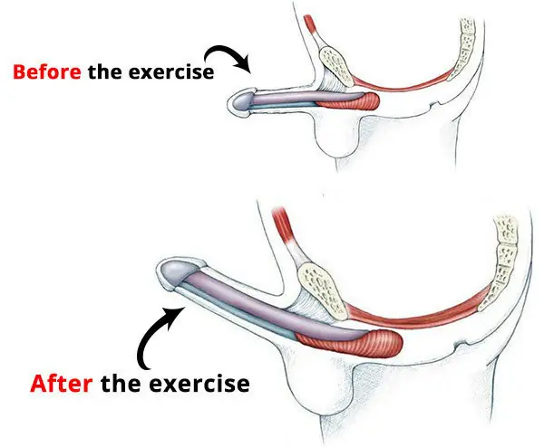 before-after-kegel-exercise